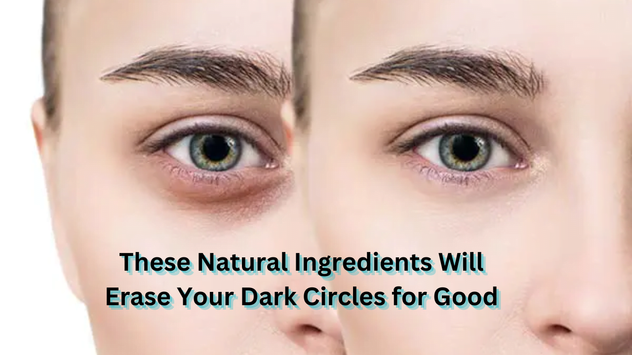 <strong>These Natural Ingredients Will Erase Your Dark Circles for Good</strong>